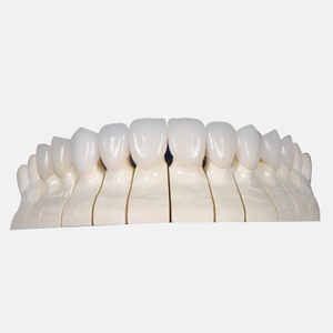 Porcelain Laminate Veneer