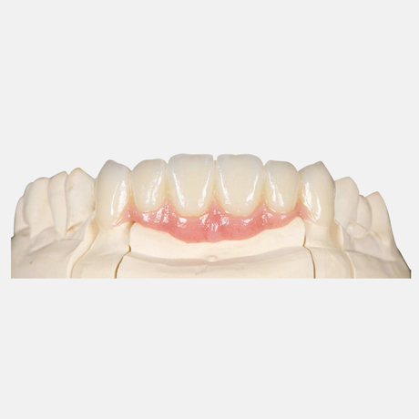 Zirconia-Bridge2.jpg