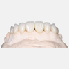 Zirconia Crown