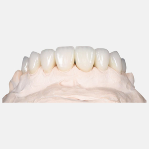 Zirconia Crown