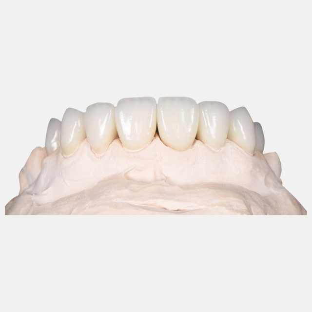 Zirconia Crown