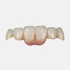 Zirconia Bridge