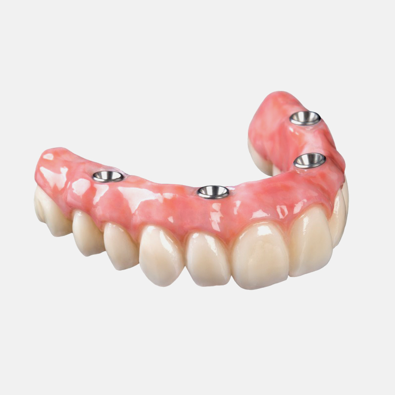 How Can Framework Design Improve Partial Denture Stability?