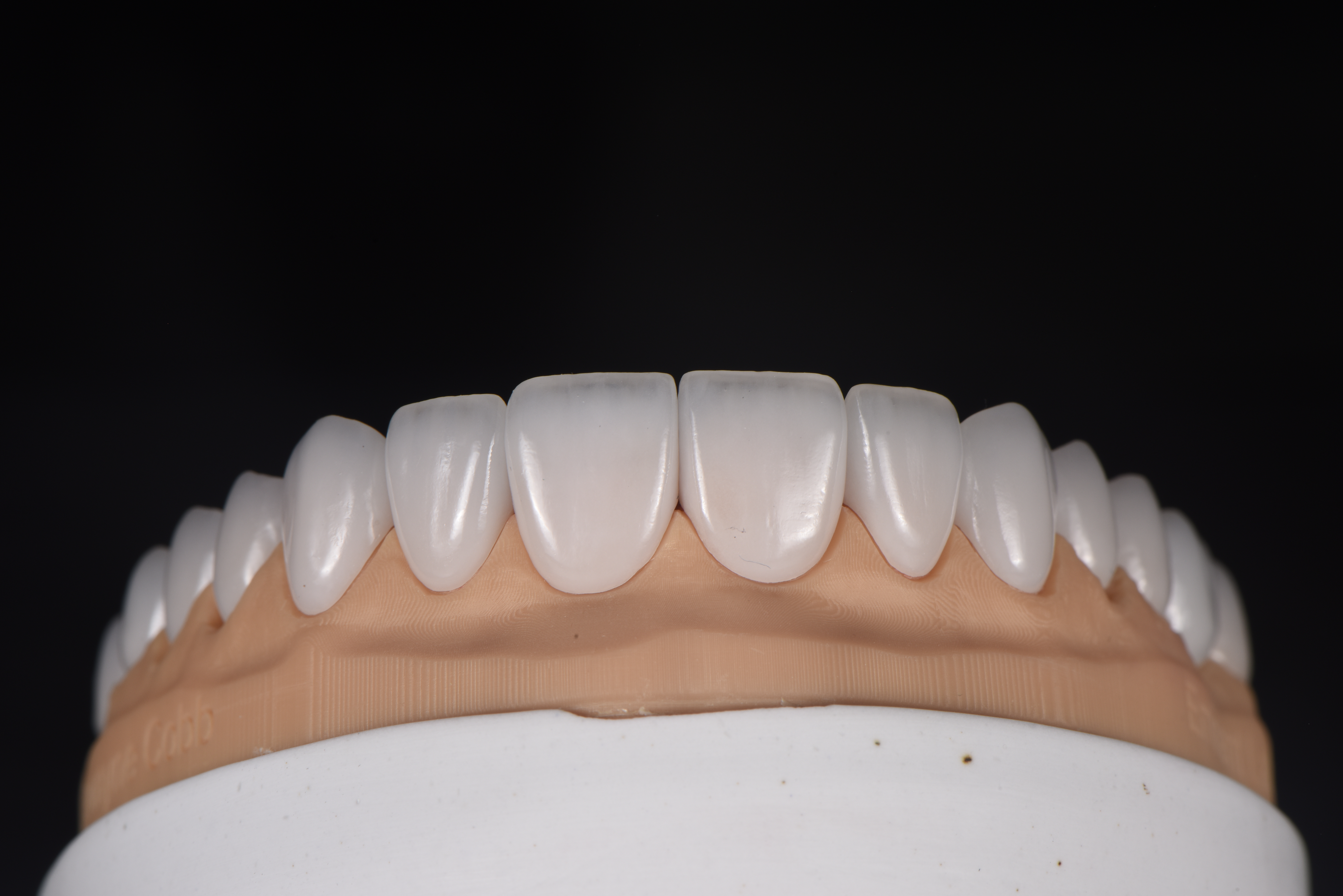 What Is The Difference Between Porcelain Laminate Veneer And Porcelain Veneers?