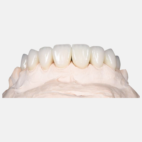 news_main_image_Zirconia-Crown3947123167177480201.jpg