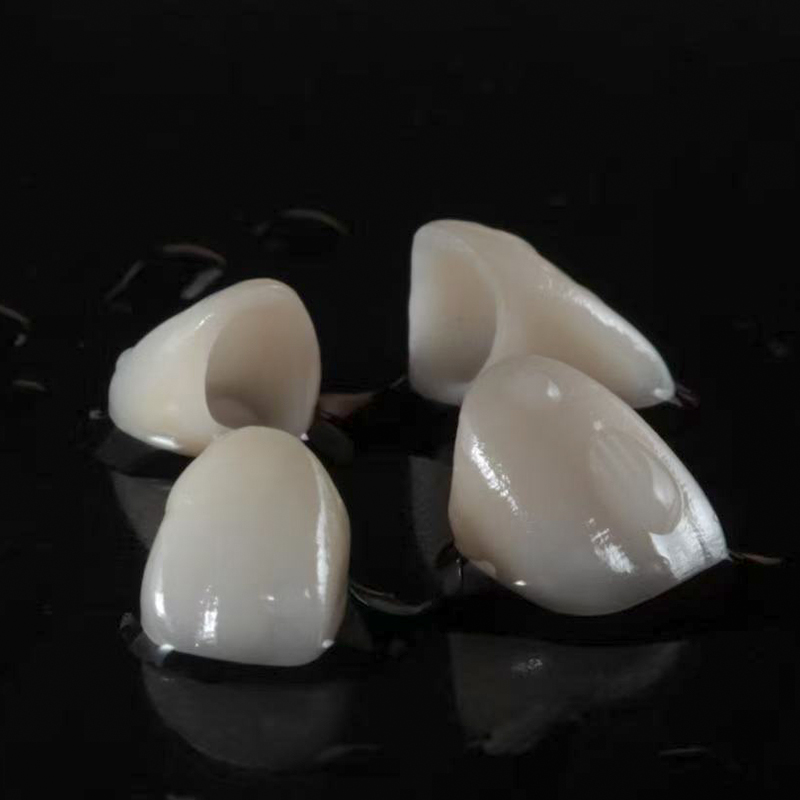 Zirconia Crown Proximal Contact